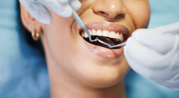 Best Emergency Dentist for Lost Fillings or Crowns in Bedminster, NJ