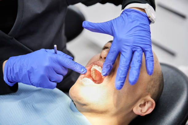 Best Emergency Dental Extractions in Bedminster, NJ